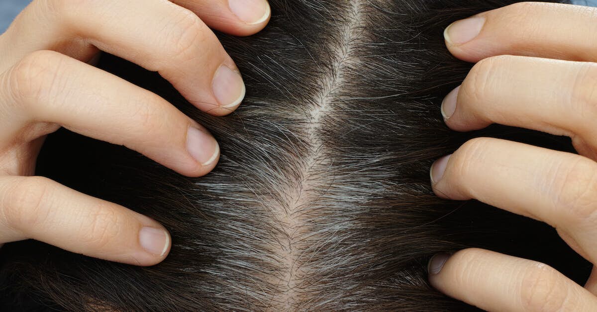 Simple Strategy that’s Clinically Proven to Reverse Graying Hair about Genesis
