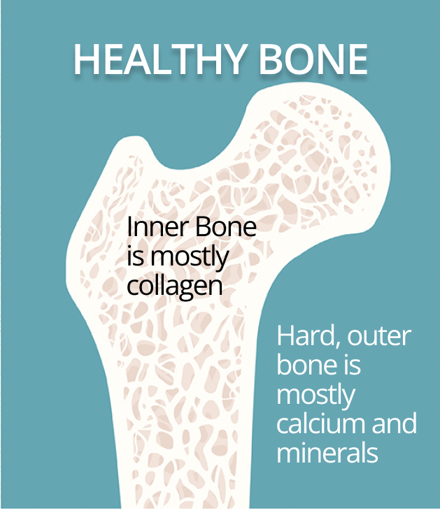 Bones