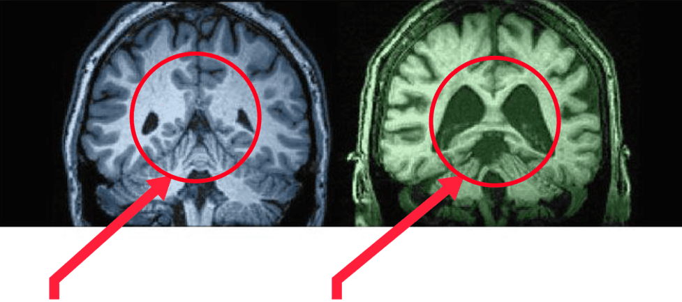 Brain comparison infographic #2