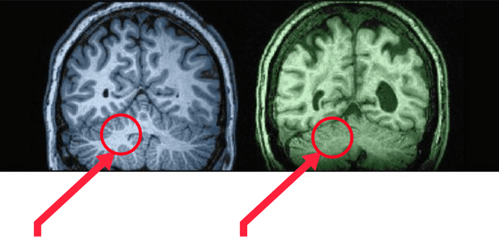 Brain comparison infographic #3