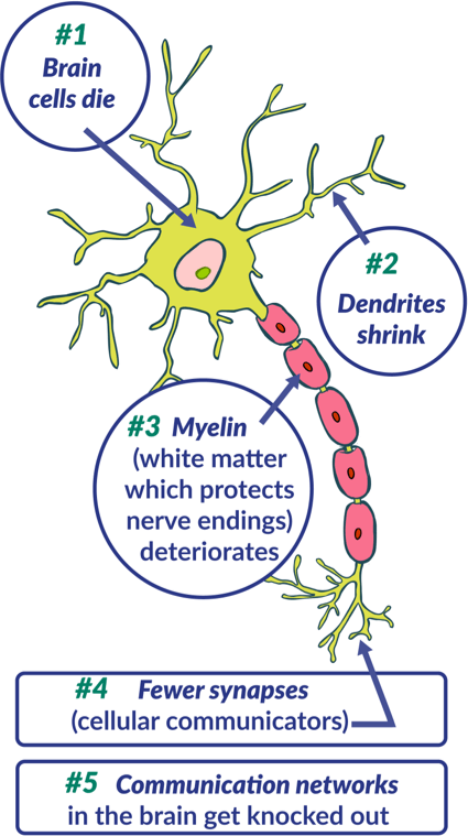 Your Incredible Shrinking Brain